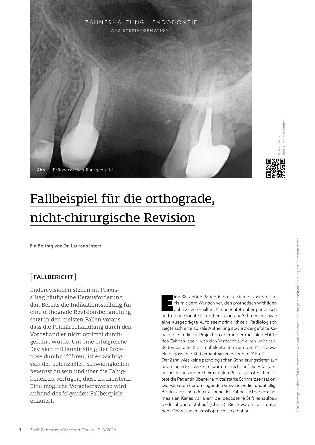 komet-dental-diao-komet-praxis-2024-07-fachbericht-endodontie image 1