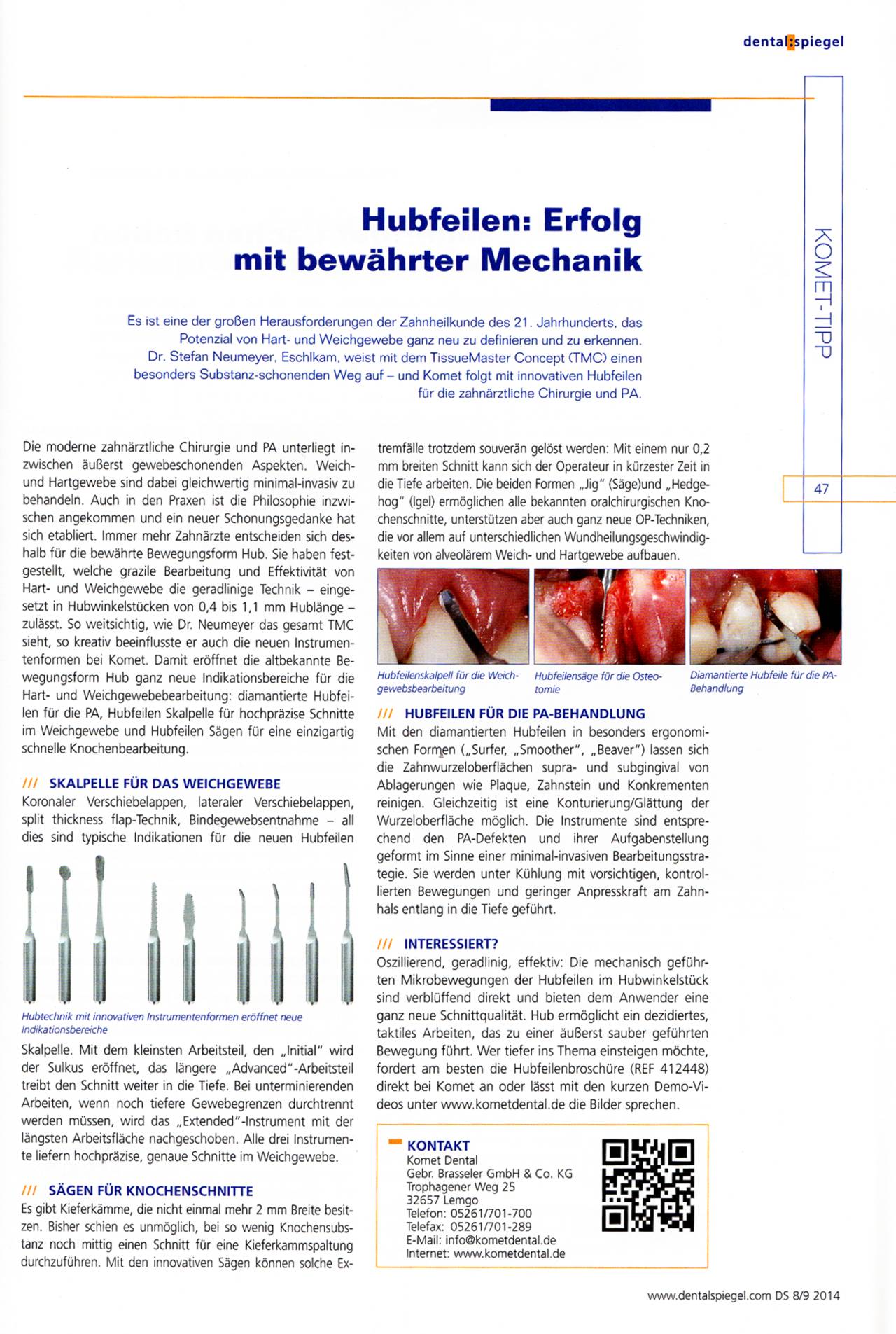 komet-dental-diao-komet-tipp-2014-hubfeilen-mechanik image 1