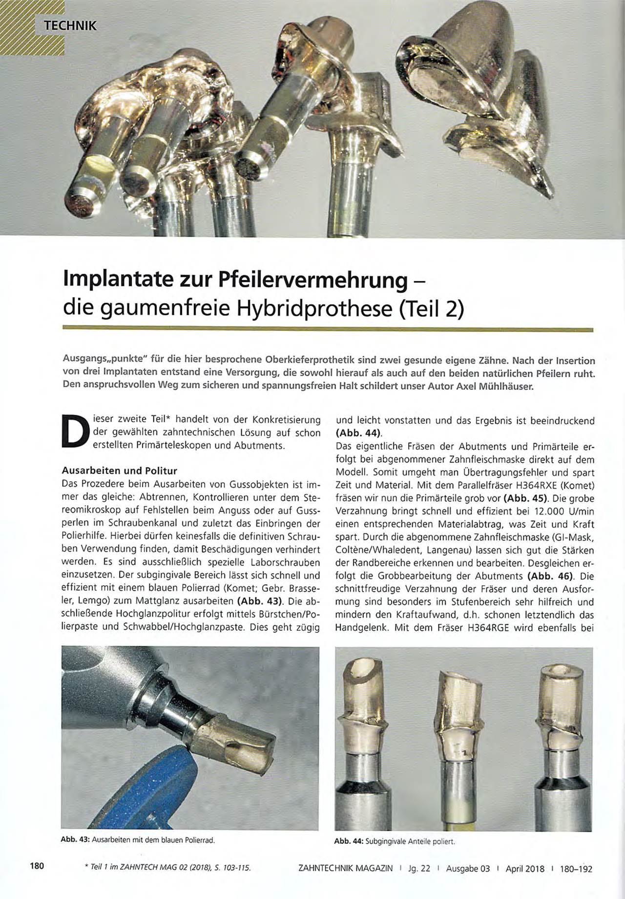 komet-fq-fachbericht-hybridprothese-implantate image 1