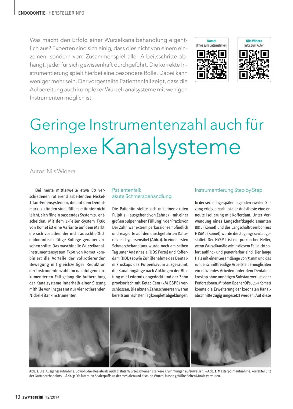 komet-dental-f360-fachbericht-patientenfall-zwp-12-2014 image 1