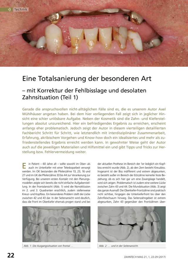 komet-diao-fachbericht-totalsanierung-fehlbisslage image 1