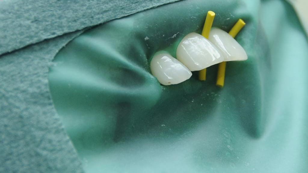 luxator-drydam-kofferdam-gesichtsmaske-zur-zahnisolierung image 4