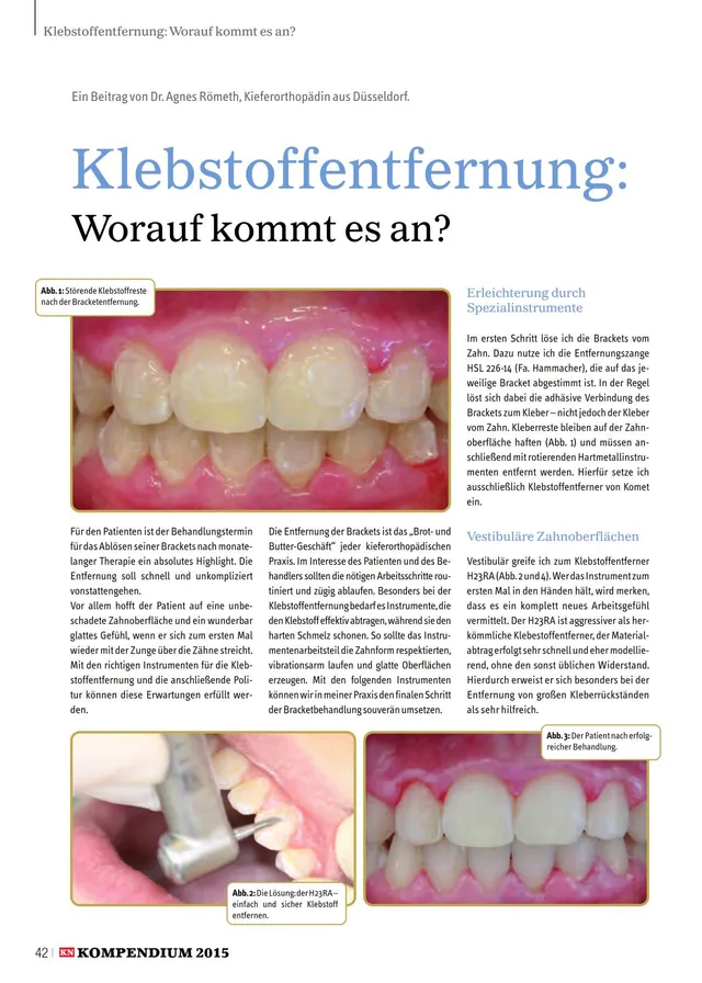 komet-diao-fachbericht-klebstoffentfernung-12-2015 image 1