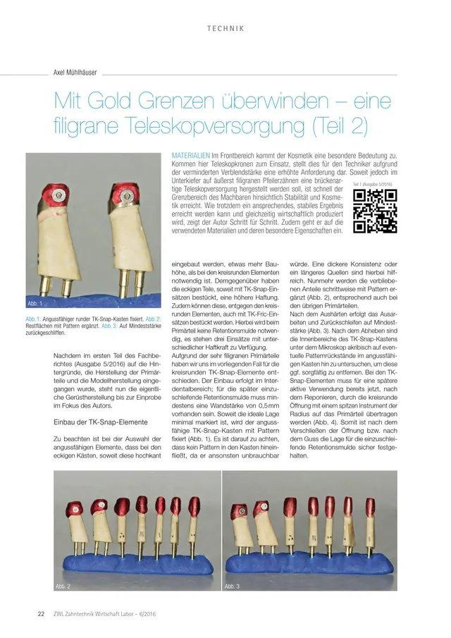 komet-diao-mit-gold-grenzen-berwinden-fachbericht-teleskopversorgung image 1