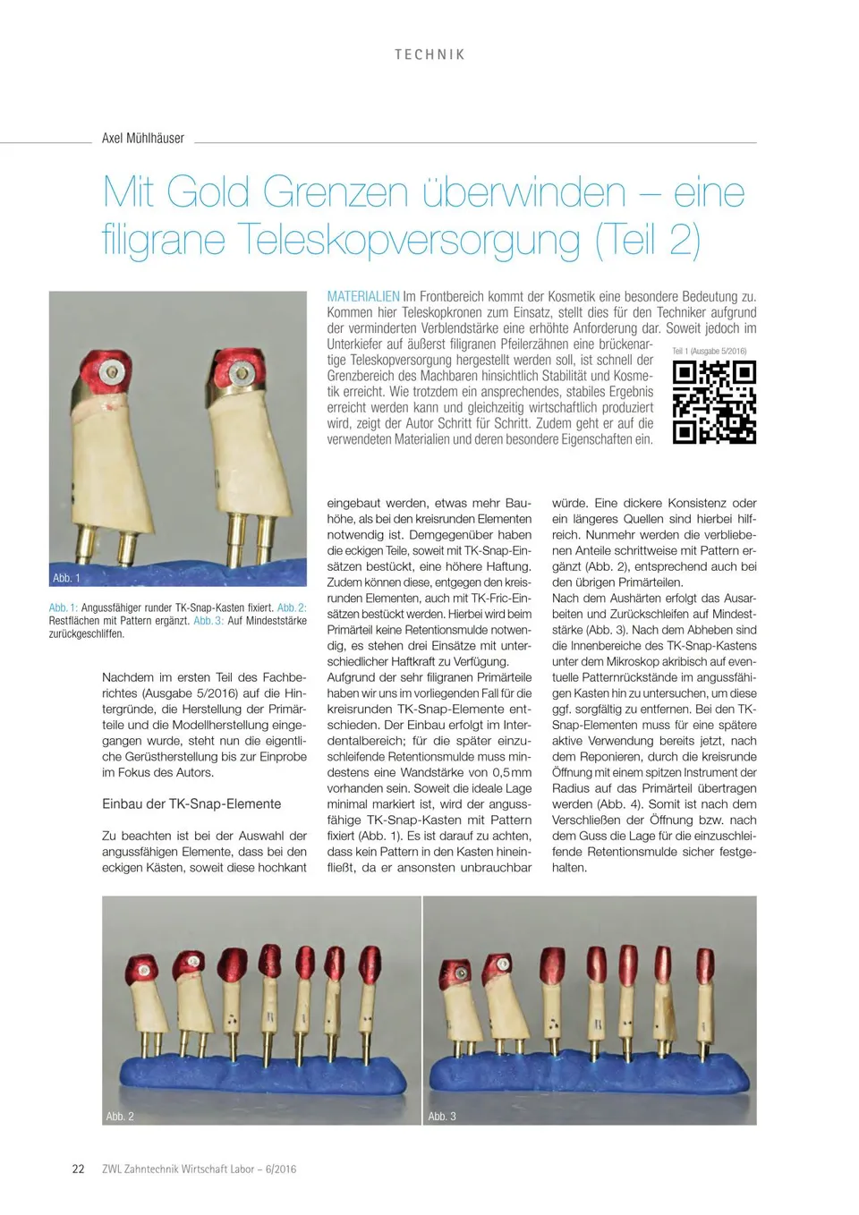 komet-diao-mit-gold-grenzen-berwinden-fachbericht-teleskopversorgung image 1