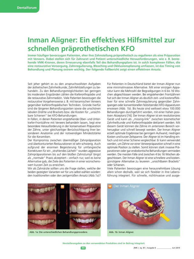 komet-sonicline-hilfsmittel-pr-prothetische-kfo-fachbericht image 1