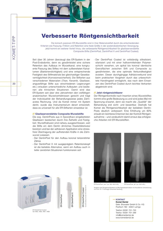 komet-diao-2012-11-composite-stifte-wurzelstift-r-ntgen image 1
