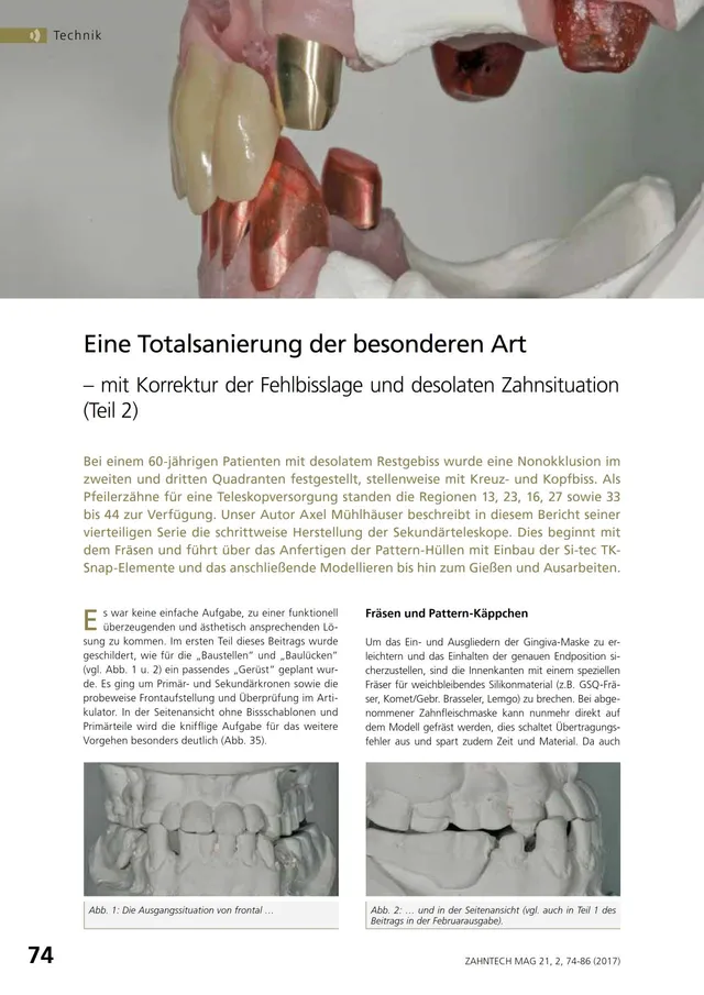 komet-dental-diao-fachbericht-totalsanierung-teil-2 image 1