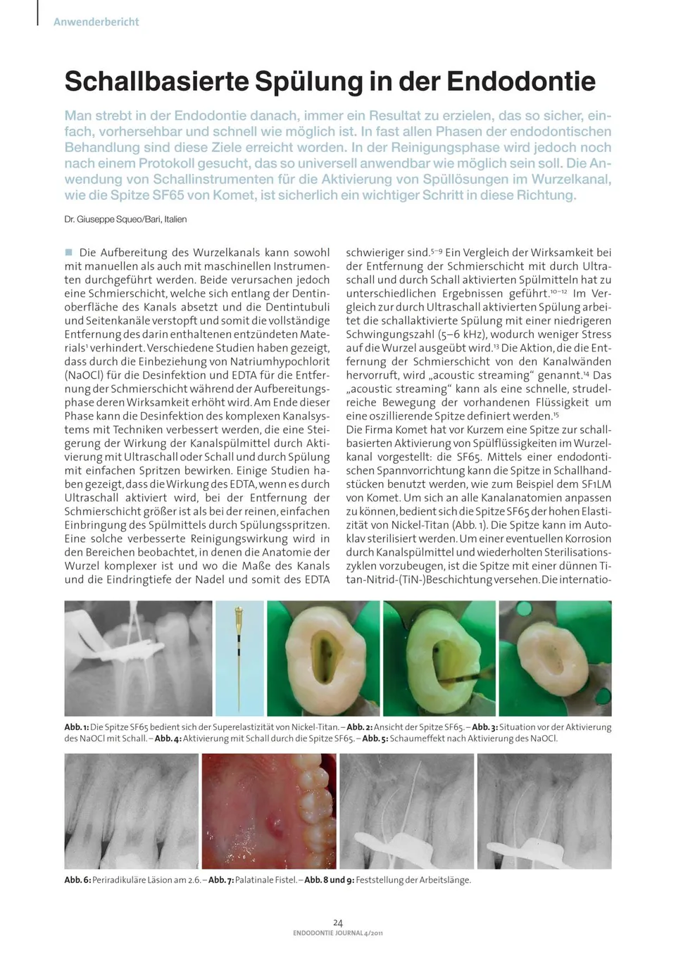 komet-dental-sonicline-fachbericht-sf65-endo-sp-lung image 1