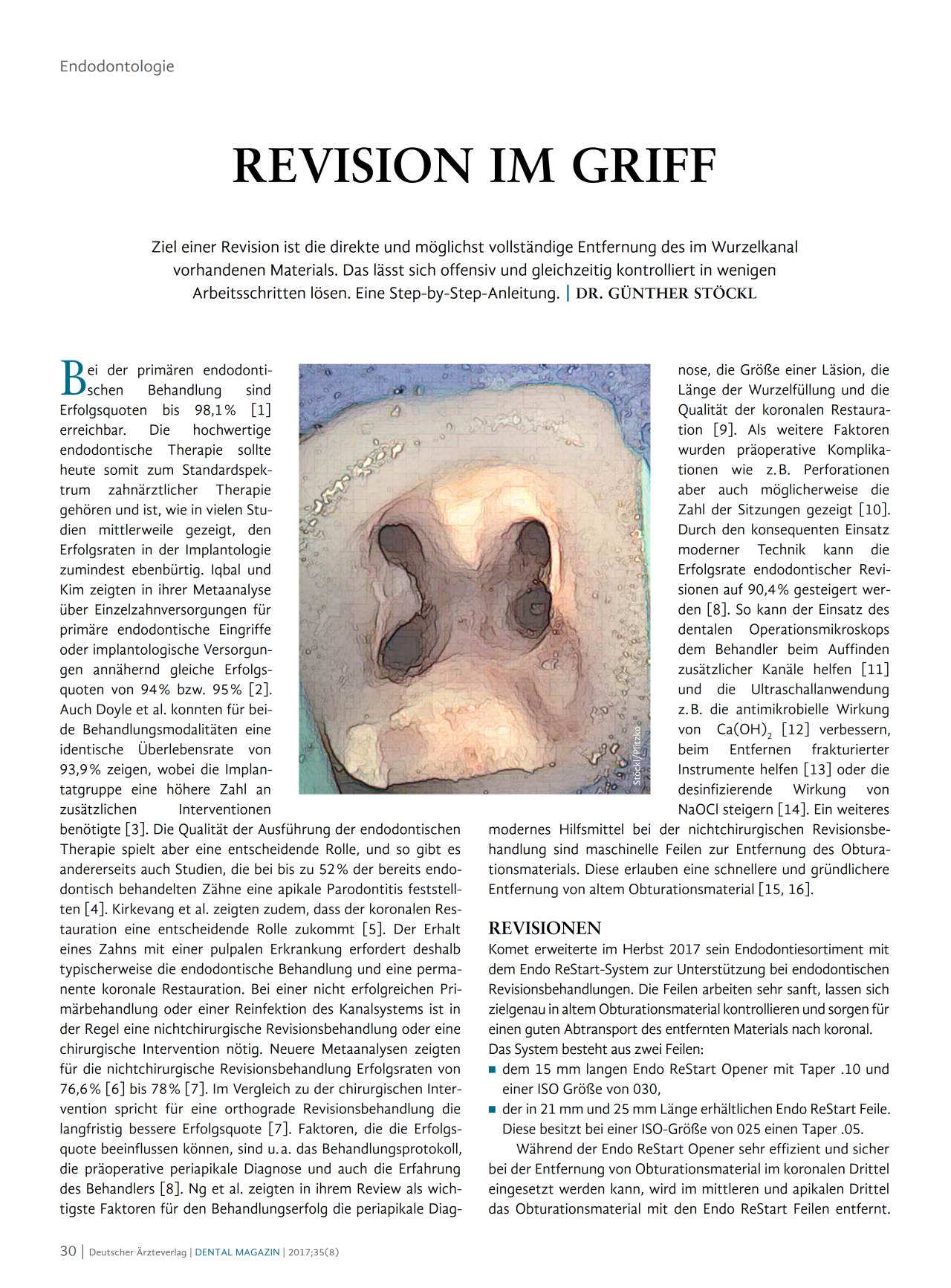 komet-dental-fq-fachbericht-revision-im-griff-step-by-step image 1