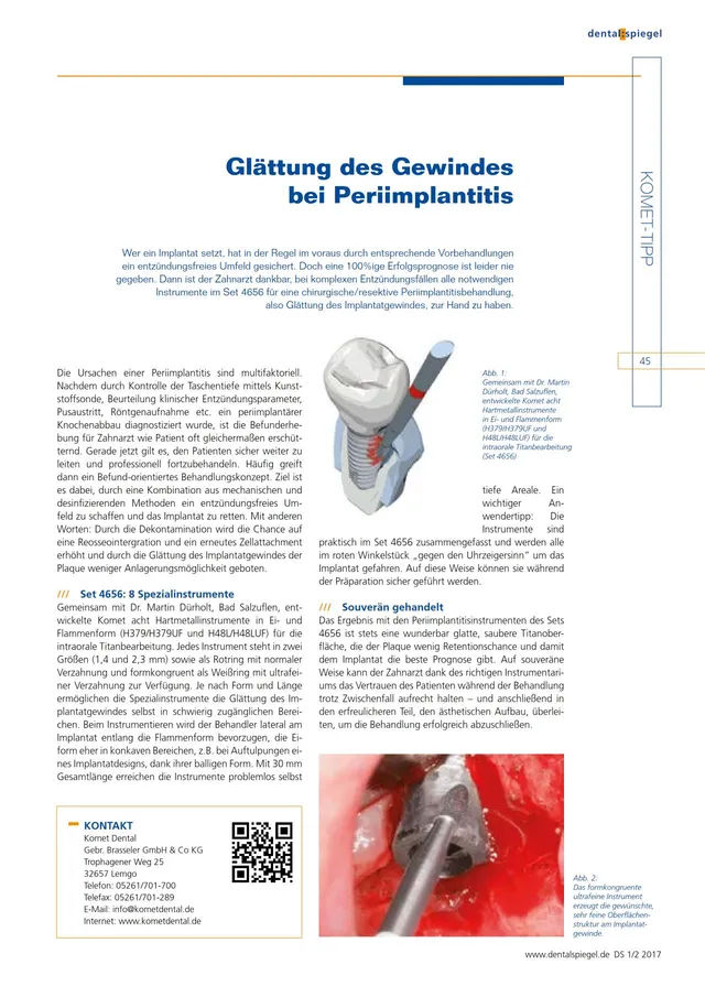 komet-diao-komet-tipp-2017-02-periimplantitis-gewinde image 1