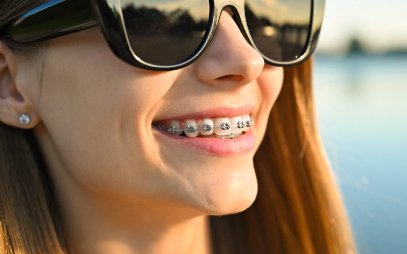 forestadent-prescriptions-brackets-mbt-mclaughlin-bennett-5-0 image 4