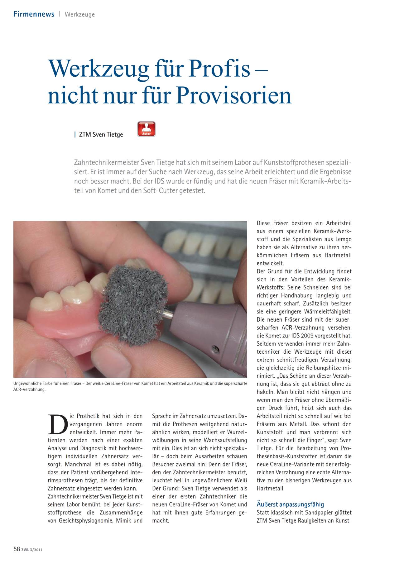 komet-dental-shax-fachbericht-laborinnovationen-ids-provisorien image 1