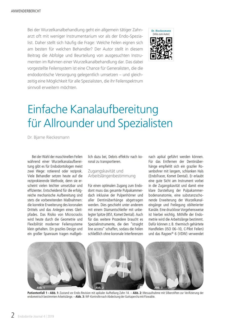 komet-dental-fq-fachbericht-kanalaufbereitung-endodontie-pdf image 1