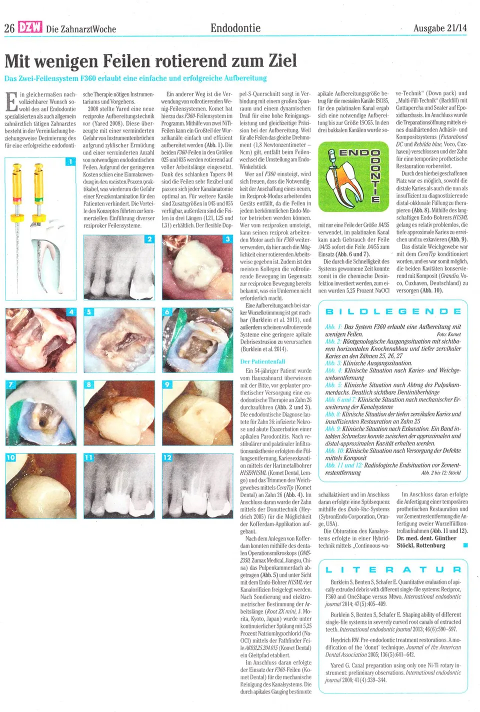 komet-dental-fq-fachbericht-f360-zwei-feilensystem-rotierend image 1