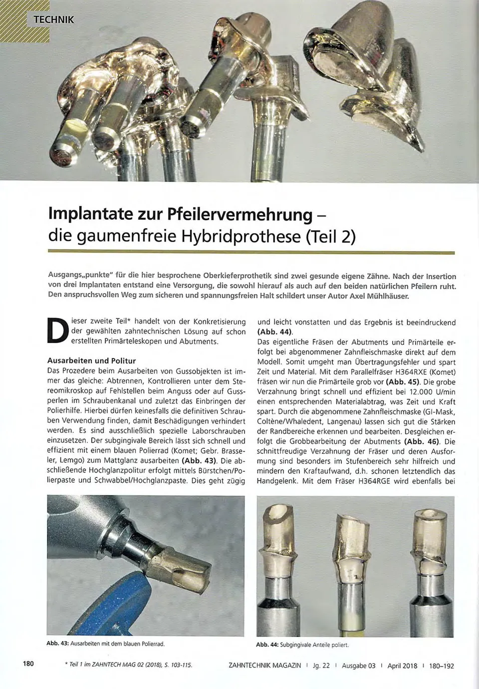 komet-fq-fachbericht-hybridprothese-implantate image 1