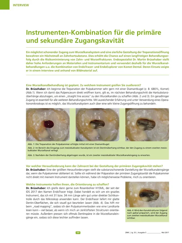 komet-dental-diao-fachbericht-zugangskavit-t-endo image 1