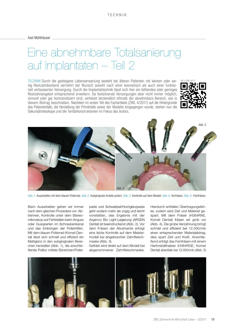 komet-dental-ceradrill-fachbericht-totalsanierung-implantat-t2 image 1