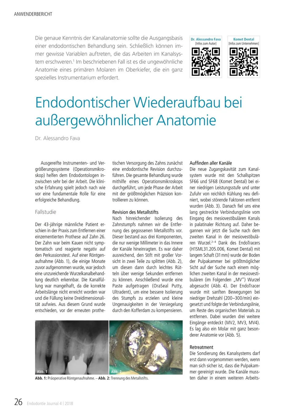 komet-fq-endo-set-wiederaufbau-anatomie-04-2018 image 1