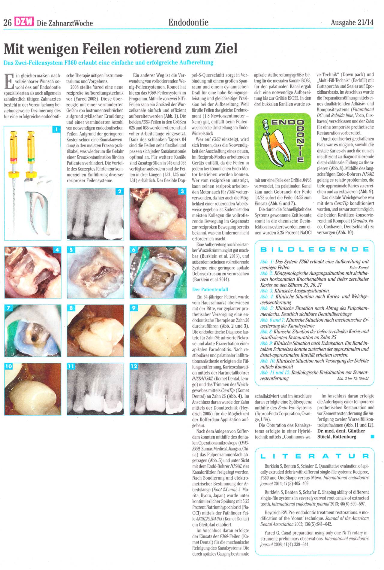 komet-dental-fq-fachbericht-f360-zwei-feilensystem-rotierend image 1