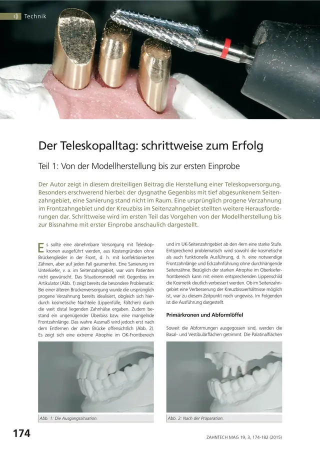 komet-diao-teleskop-set-modellherstellung-labor image 1