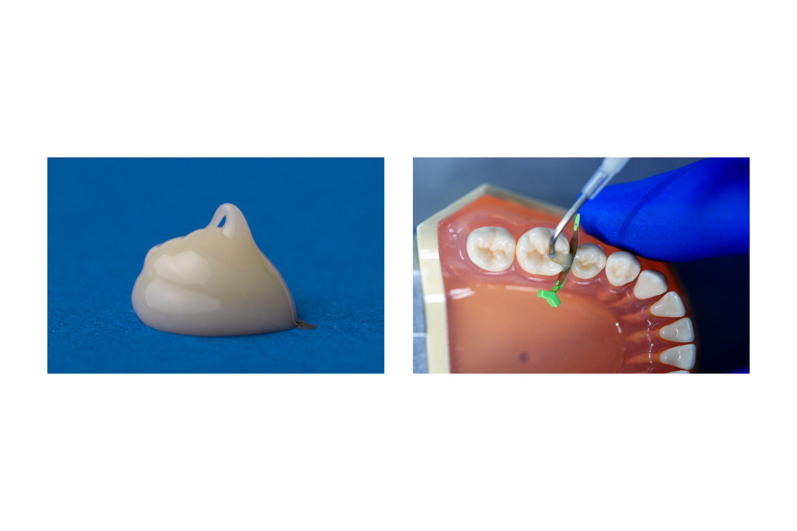 parkell-predicta-bioactive-bulk-komposit-dualh-rtend image 2
