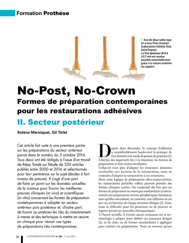 komet-dental-cerapost-fachbericht-no-post-no-crown image 1