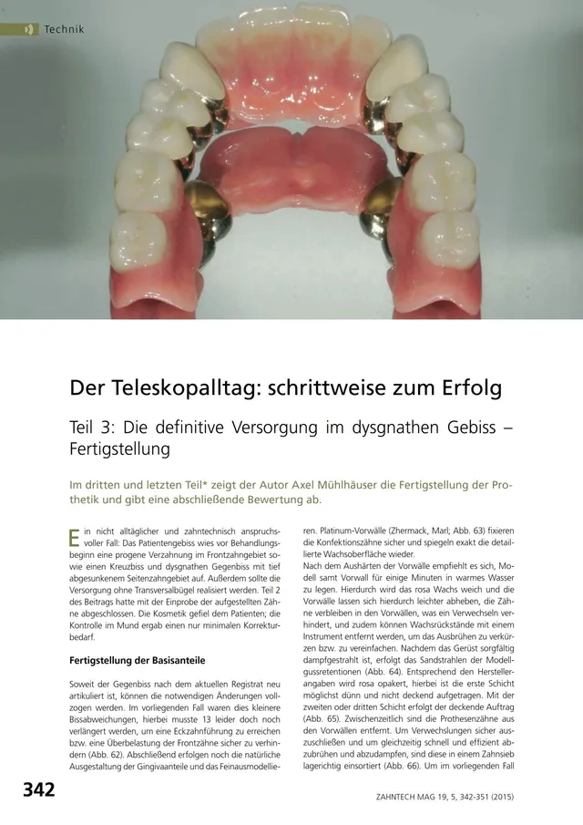 komet-dental-diao-fachbericht-teleskop-versorgung-m-hlh-user image 1