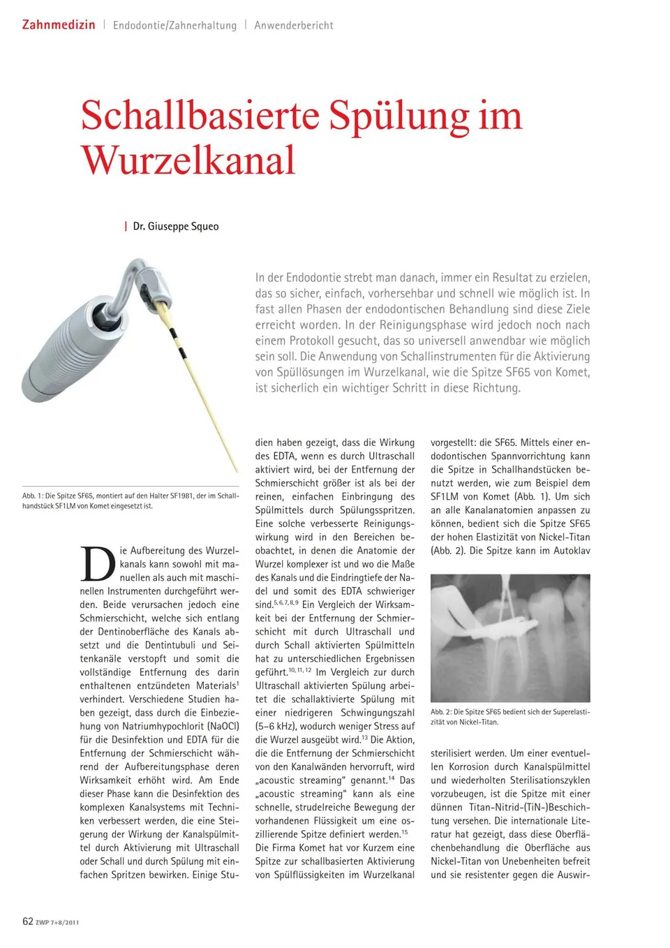 komet-diao-sf65-schall-sp-lansatz-wurzelkanal-bericht image 1