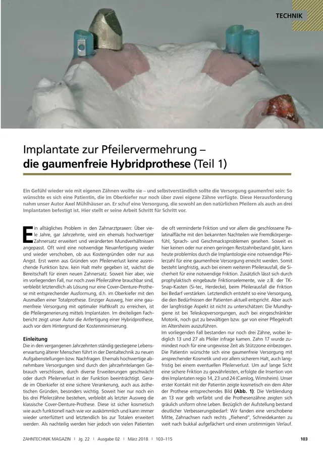 komet-dental-fq-pr-zisionsfr-ser-prothetik image 1