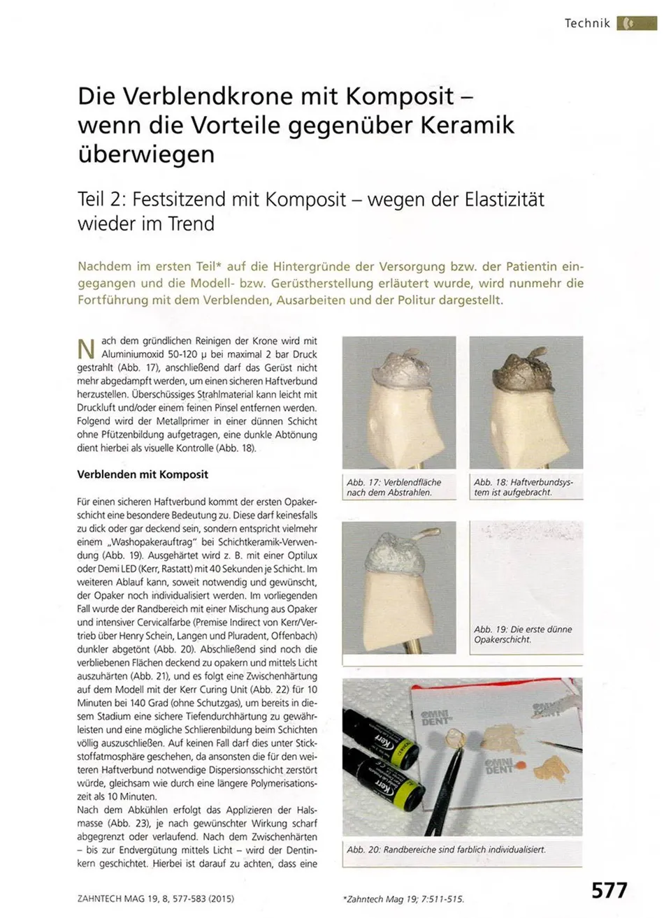 komet-ceracut-fachbericht-verblendkrone-komposit-teil-2 image 1